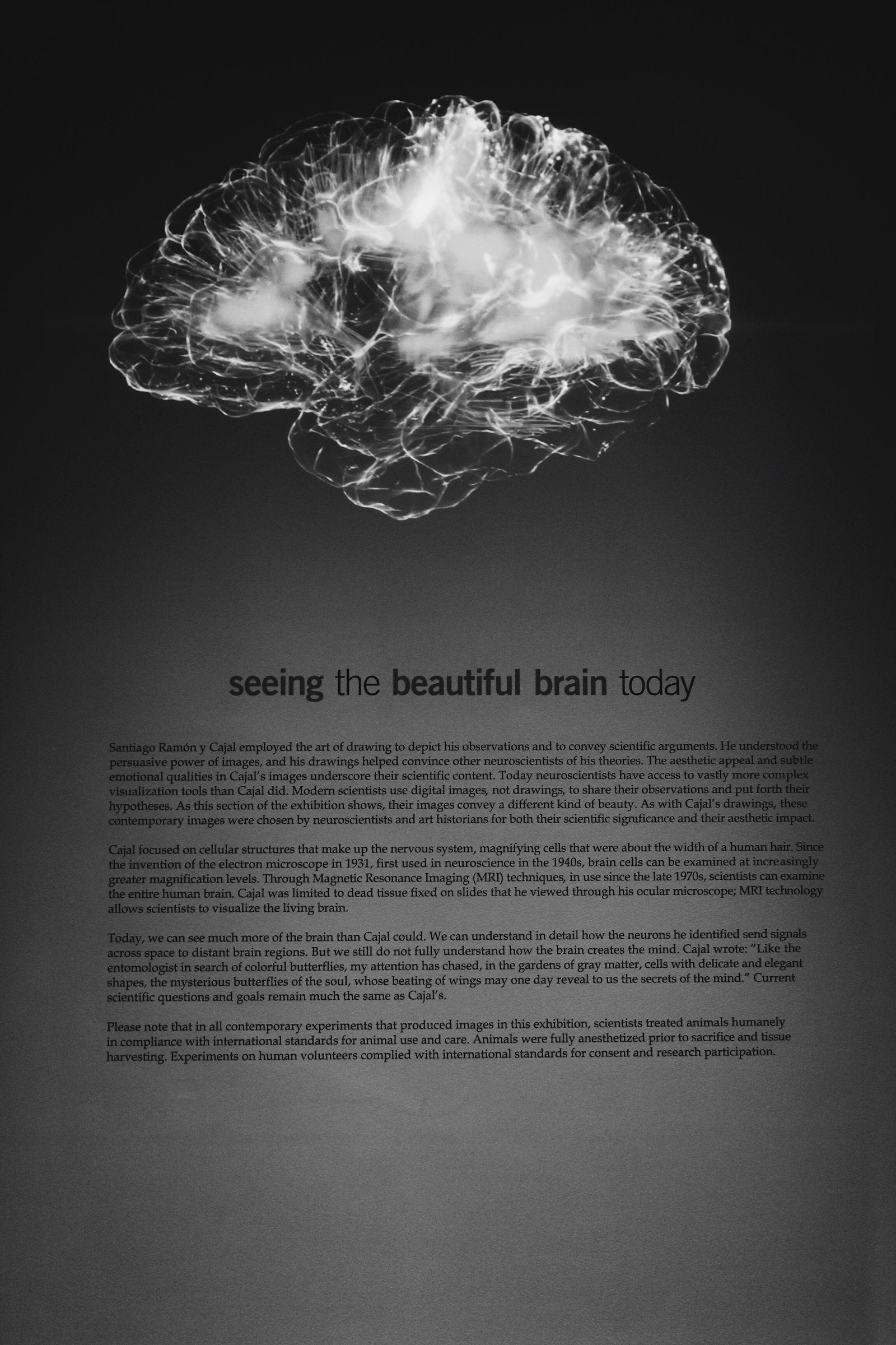 Cerveau brain fog brouillard cerebral — protocole 90 jours hydrogene moleculaire H2